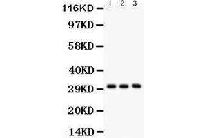 Western Blotting (WB) image for anti-Voltage-Dependent Anion Channel 1 (VDAC1) (AA 154-181), (Middle Region) antibody (ABIN3043959)