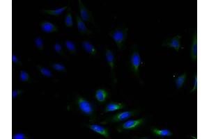 Immunofluorescent analysis of HeLa cells using Diamine acetyltransferase 1 Antibody (1/100 dilution) and AF488-conjugated Goat Anti-Rabbit IgG (H+L) secondary antibody. (SAT1 抗体  (AA 5-171))