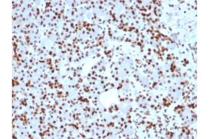 Formalin-fixed, paraffin-embedded human Pancreas stained with SOX9 Mouse Monoclonal Antibody (SOX9/2398). (SOX9 抗体  (AA 393-508))