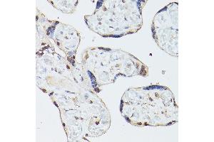 Immunohistochemistry of paraffin-embedded human placenta using ADK Rabbit pAb  at dilution of 1:350 (40x lens). (ADK 抗体  (AA 200-345))