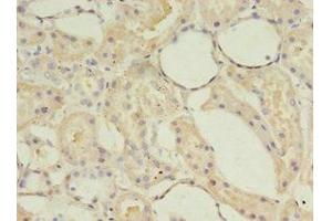 Immunohistochemistry of paraffin-embedded human kidney tissue using ABIN7143242 at dilution of 1:100 (ACOT9 抗体  (AA 1-212))