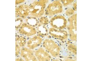 Immunohistochemistry of paraffin-embedded human kidney using CALCOCO1 antibody at dilution of 1:100 (40x lens). (CALCOCO1 抗体)