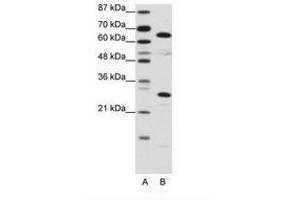 Image no. 1 for anti-High Mobility Group Box 4 (HMGB4) (C-Term) antibody (ABIN6736129) (HMGB4 抗体  (C-Term))