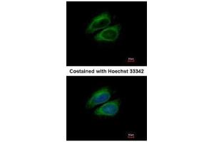 ICC/IF Image Immunofluorescence analysis of methanol-fixed HeLa, using CSDE1, antibody at 1:200 dilution. (CDSE1 抗体  (Internal Region))