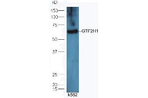 Western Blotting (WB) image for anti-General Transcription Factor IIH, Polypeptide 1, 62kDa (GTF2H1) (AA 201-300) antibody (ABIN873029)