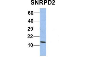 Host:  Rabbit  Target Name:  SNRPD2  Sample Type:  Human Jurkat  Antibody Dilution:  1. (SNRPD2 抗体  (Middle Region))