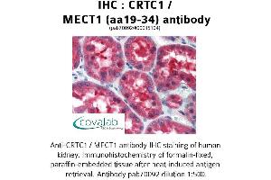 Image no. 1 for anti-CREB Regulated Transcription Coactivator 1 (CRTC1) (AA 19-34) antibody (ABIN1733326) (CRTC1 抗体  (AA 19-34))