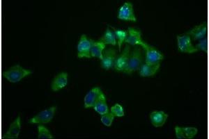 Immunofluorescence staining of Hela cells with ABIN7127637 at 1:23, counter-stained with DAPI. (Recombinant NDRG1 抗体)