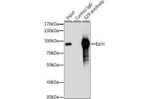 Immunoprecipitation analysis of 200 μg extracts of 293T cells, using 3 μg Ezrinin antibody (ABIN6129377, ABIN6140400, ABIN6140401 and ABIN6213959). (Ezrin 抗体  (AA 350-470))