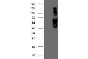Western Blotting (WB) image for anti-Iduronate 2-Sulfatase (IDS) antibody (ABIN1498797) (IDS 抗体)