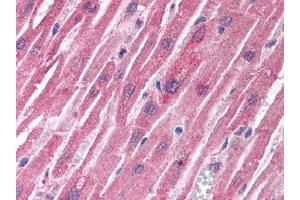 Image no. 1 for anti-Tuberous Sclerosis 1 (TSC1) antibody (ABIN302894) (TSC1 抗体)