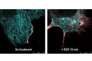 Immunofluorescence (IF) image for anti-V-Akt Murine Thymoma Viral Oncogene Homolog 1 (AKT1) (pSer473) antibody (ABIN964561)