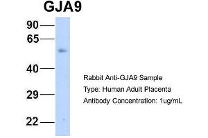 Host: Rabbit Target Name: GJA9 Sample Type: Human Adult Placenta Antibody Dilution: 1. (GJA9 抗体  (Middle Region))