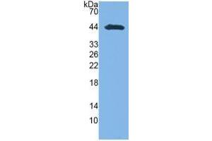 WB of Protein Standard: different control antibodies against Highly purified E. (GOT1 ELISA 试剂盒)
