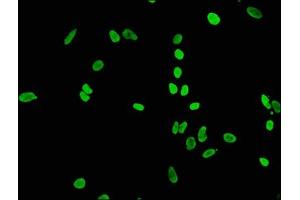 Immunofluorescence staining of Hela cells(treated by 15 mM sodium butyrate for 30 min) with ABIN7127271 at 1:65,counter-stained with DAPI. (Recombinant HIST1H4A 抗体  (acLys56))