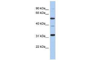 MGC51025 antibody used at 1 ug/ml to detect target protein. (TBC1D26 抗体  (Middle Region))