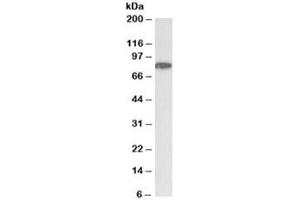 Western blot testing of HeLa nuclear lysate with CHUK antibody at 1ug/ml. (IKK alpha 抗体)