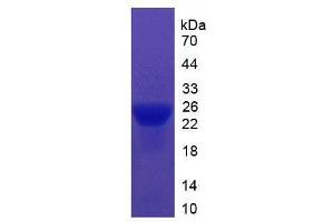 SDS-PAGE analysis of Mouse ITIH5 Protein. (ITIH5 蛋白)