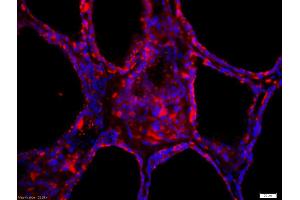 Formalin-fixed and paraffin-embedded human thyroid labeled with Anti-Thyroid peroxidase Polyclonal Antibody, Unconjugated (ABIN668736) 1:200, overnight at 4°C, The secondary antibody was Goat Anti-Rabbit IgG, Cy3 conjugated used at 1:200 dilution for 40 minutes at 37°C. (Thyroperoxidase 抗体  (AA 351-450))
