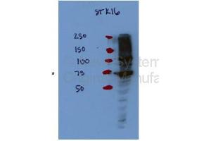STK16 antibody - middle region  validated by WB using Hek 293T Cells at 1:1000. (STK16 抗体  (Middle Region))