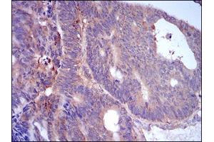 Immunohistochemistry (IHC) image for anti-Perilipin 2 (PLIN2) (AA 286-437) antibody (ABIN1724917)