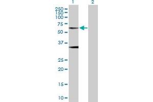 Western Blot analysis of GLRA1 expression in transfected 293T cell line by GLRA1 MaxPab polyclonal antibody. (GLRA1 抗体  (AA 1-449))