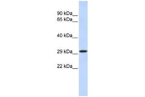 KLF14 antibody used at 1. (KLF14 抗体  (N-Term))