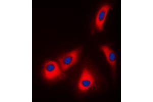 Immunofluorescent analysis of Adenosine Kinase staining in HepG2 cells. (ADK 抗体  (N-Term))
