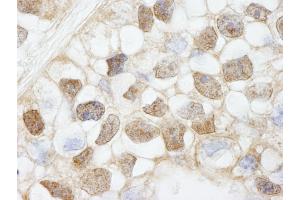 Immunohistochemistry (IHC) image for anti-Histone Deacetylase 7 (HDAC7) (AA 902-952) antibody (ABIN7448594)
