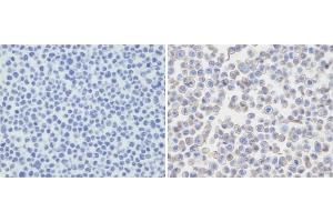 Immunohistochemical analysis of PDL-2 in untransfected(left) or transfected(right) with 293T cell sections. (PDCD1LG2 抗体  (N-Term))