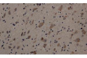 Immunohistochemistry of paraffin-embedded Rat brain using Cleaved-NOTCH1 (V1754) Polyclonal Antibody at dilution of 1:200 (Notch1 抗体  (Cleaved-Val1754))
