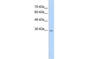 Western Blotting (WB) image for anti-Chromosome 6 Open Reading Frame 134 (C6orf134) antibody (ABIN2462612) (Chromosome 6 Open Reading Frame 134 (C6orf134) 抗体)