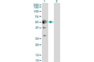 Western Blot analysis of SEPT10 expression in transfected 293T cell line by SEPT10 monoclonal antibody (M01), clone 2A12. (Septin 10 抗体  (AA 1-454))