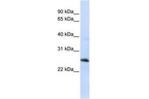 Image no. 1 for anti-Reticulon 1 (RTN1) (C-Term) antibody (ABIN6741063) (Reticulon 1 抗体  (C-Term))
