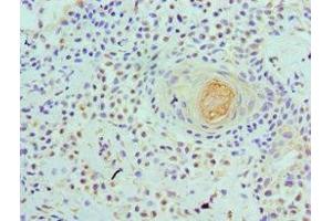 Immunohistochemistry of paraffin-embedded human breast tissue using ABIN7175761 at dilution of 1:100 (WDR5 抗体  (AA 1-334))