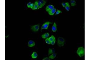 Immunofluorescence staining of MCF-7 cells with ABIN7160831 at 1:133, counter-stained with DAPI. (NLRP6 抗体  (AA 154-306))