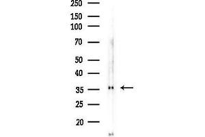 anti-Trans-2,3-Enoyl-CoA Reductase (TECR) (Internal Region) antibody