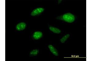 Immunofluorescence of purified MaxPab antibody to DDX50 on HeLa cell. (DDX50 抗体  (AA 1-737))