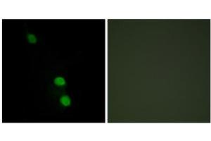 Immunofluorescence analysis of HepG2 cells, using TEAD2 antibody. (TEAD2 抗体  (Internal Region))