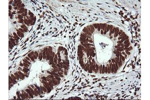 Image no. 7 for anti-THUMP Domain Containing 1 (THUMPD1) antibody (ABIN1501384) (THUMPD1 抗体)