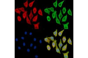 anti-Parathyroid Hormone 2 (PTH2) antibody