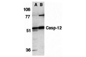 Western Blotting (WB) image for anti-Caspase 12 (Gene/pseudogene) (CASP12) (N-Term) antibody (ABIN1031295) (Caspase 12 抗体  (N-Term))
