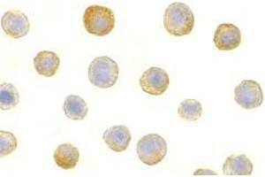 Immunocytochemistry of IL-1RAcP in HeLa cells with AP30412PU-N IL-1RAcP antibody at 5 μg/ml. (FBXO43 抗体  (C-Term))