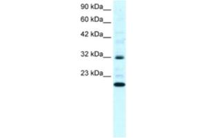 Western Blotting (WB) image for anti-rho GDP Dissociation Inhibitor (GDI) gamma (ARHGDIG) antibody (ABIN2460825) (ARHGDIG 抗体)