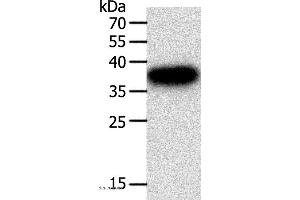 Western blot analysis of A549 cell, using PLAUR Polyclonal Antibody at dilution of 1:400 (PLAUR 抗体)