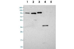 Western blot analysis of Lane 1: RT-4, Lane 2: U-251 MG, Lane 3: Human Plasma, Lane 4: Liver, Lane 5: Tonsil with CCDC19 polyclonal antibody  at 1:100-1:250 dilution. (CCDC19 抗体)