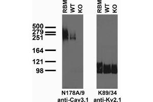 Immunoblot of crude brain membranes from adult rat (RBM) and Cav3. (Cav3.1 Ca2+ Channel (AA 2052-2172), (C-Term), (Cytosolic) 抗体)