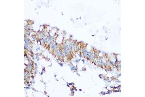 Immunohistochemistry of paraffin-embedded human colon using SIRT4 Rabbit pAb (ABIN6129330, ABIN6147796, ABIN6147797 and ABIN6223494) at dilution of 1:100 (40x lens). (SIRT4 抗体  (AA 29-260))