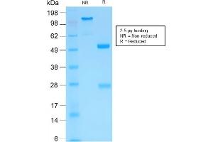SDS-PAGE Analysis of Purified MMP3 Rabbit Recombinant Monoclonal Antibody (MMP3/1994R). (Recombinant MMP3 抗体  (AA 317-327))