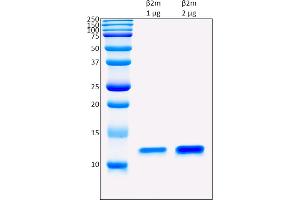SDS-PAGE (SDS) image for beta-2-Microglobulin (B2M) protein (ABIN5675808) (beta-2 Microglobulin 蛋白)